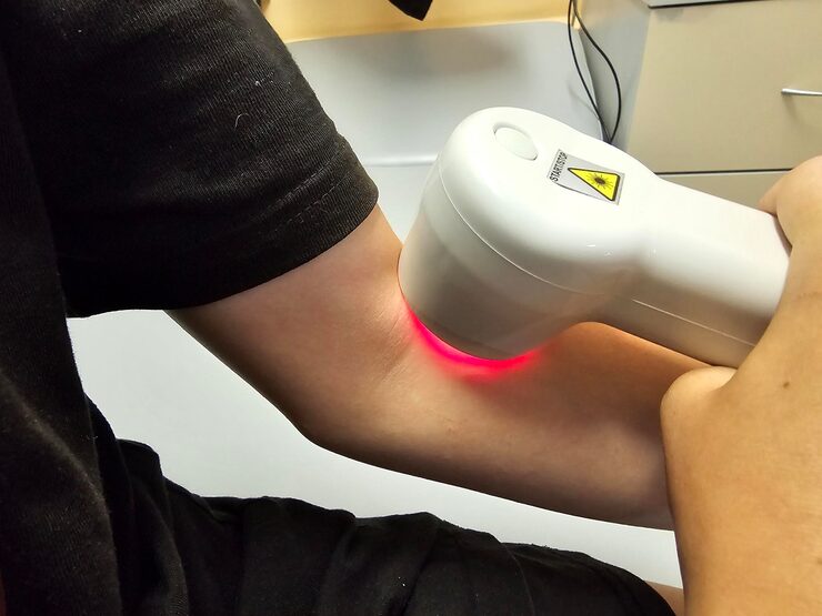 Cold Laser Therapy